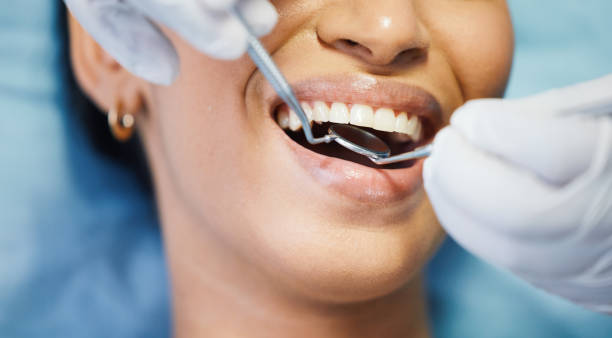 Best Emergency Tooth Extraction in Uniontown, PA